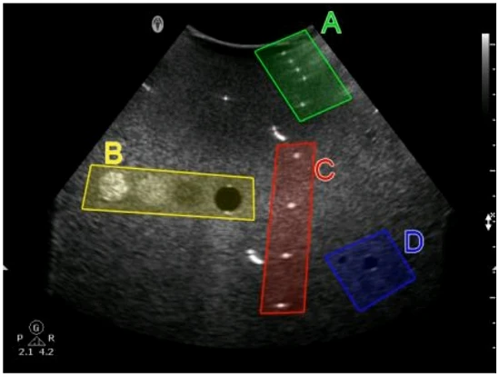 Exam SPI: Question 7 - Image 1